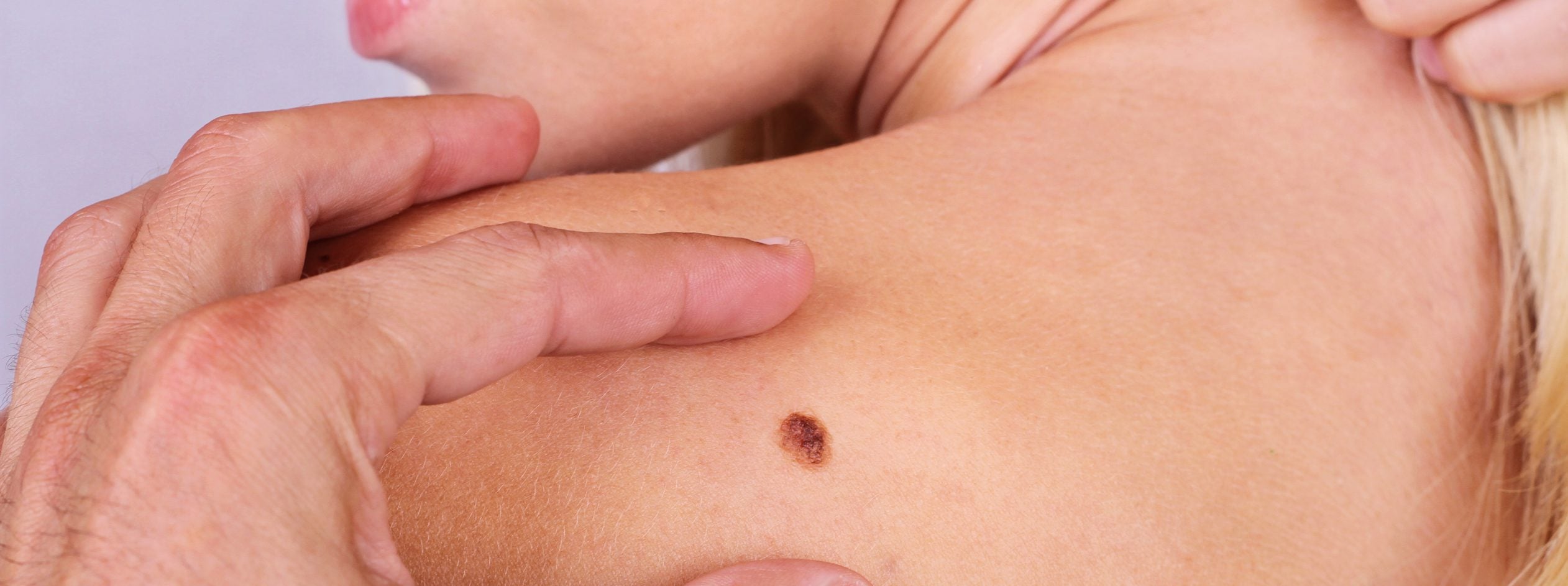 Is Surgery To Remove Skin Cancer Necessary Revere Health Is Surgery To Remove Skin Cancer Necessary Revere Health