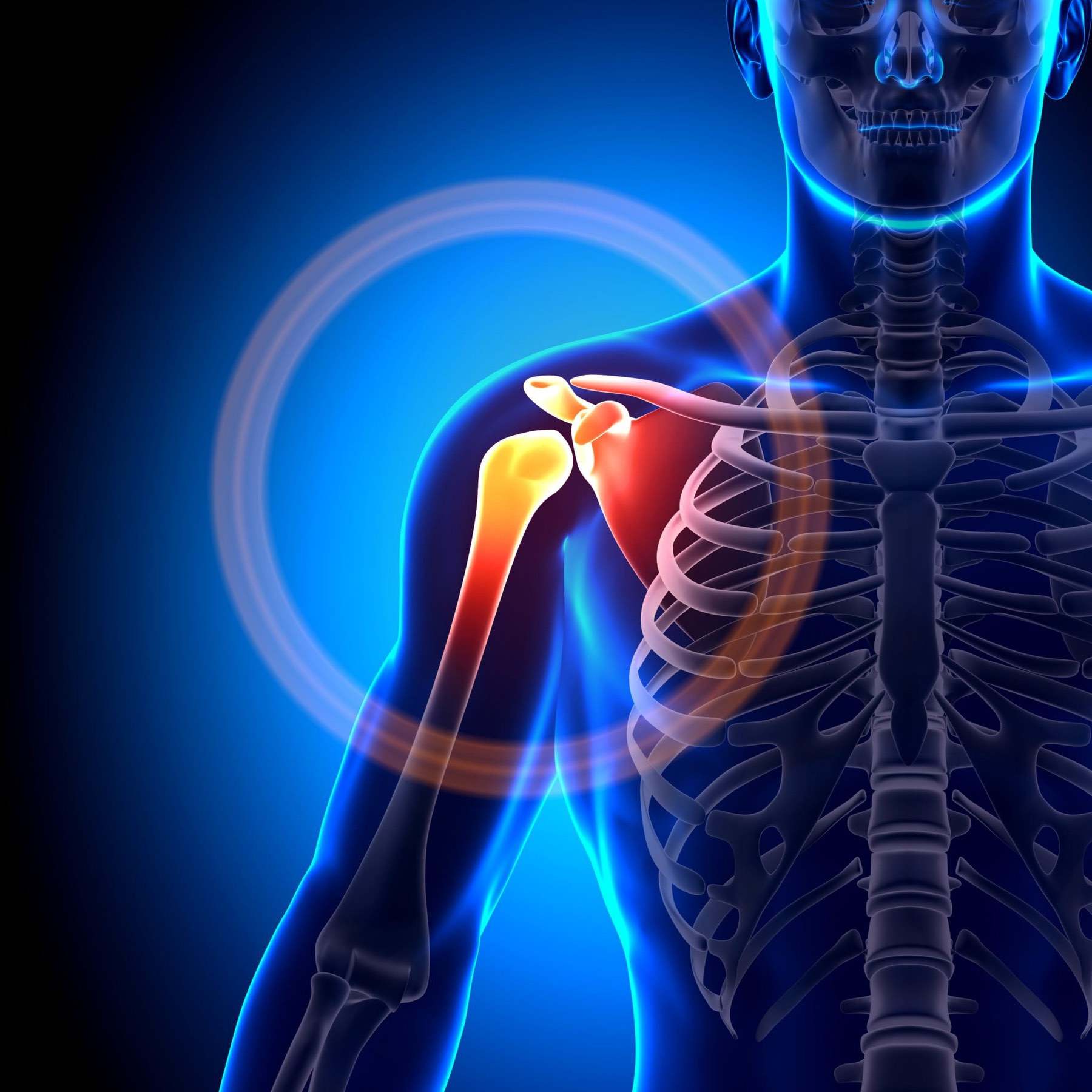 Understanding Dislocation - Revere Health